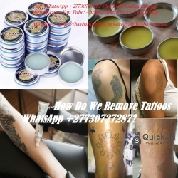 How Do We Remove Tattoos WhatsApp +27730727287?